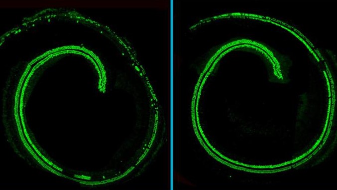 CRISPRで遺伝性難聴を治療、マウスで効果を確認